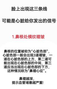 鼻梁有橫紋是怎么回事   鼻梁有橫紋面相分析大全