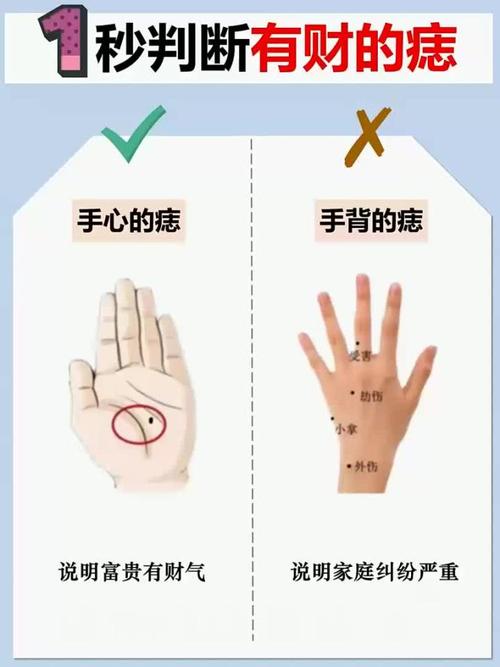 女人全身痣相 手掌中長痣做事效率高