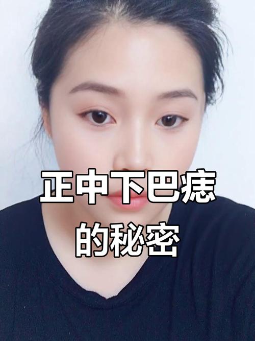 下巴長痣的女人面相 下巴正中間有顆痣的女人