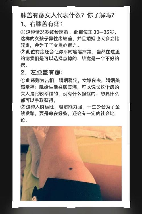 左腿有痣的女人 女人左腿上長有痣代表什么