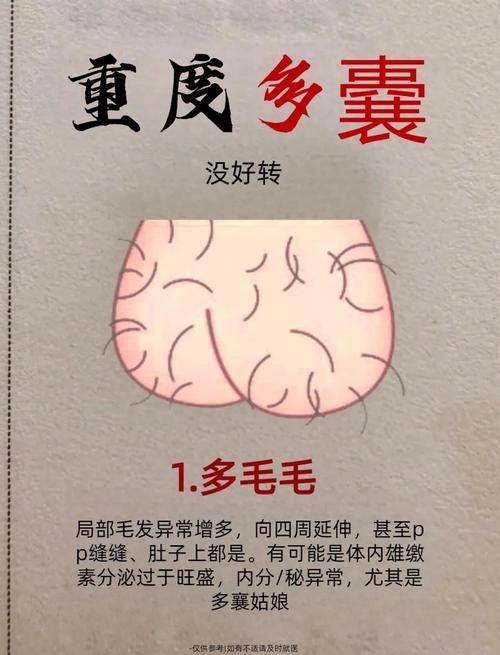 體毛也能看命運