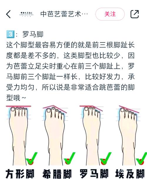 女人羅馬腳有什么說法