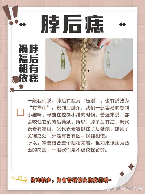脖子后面后邊上正中間有長痣的代表什么 脖子后正中有痣的女人
