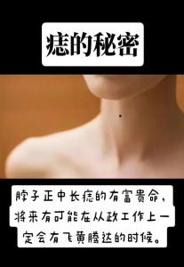 女人脖子前面有痣代表什么 前脖子頸部正中間有痣的女人好嗎