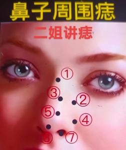 女人鼻梁上有痣 鼻梁右側有痣的女人好嗎