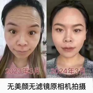 抬頭紋面相 抬頭紋的人是好還是不好