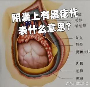 蛋蛋長(zhǎng)痣代表什么 男人蛋蛋上有痣代表啥