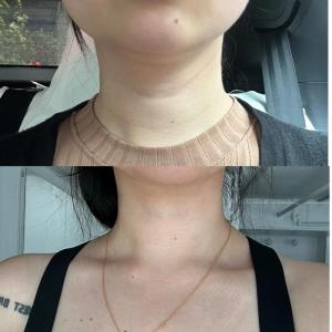 脖子看你的人生是否幸福