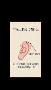 耳朵背后輪廓前面有長黑痣代表什么痣相圖解 耳朵里長痣有什么說法