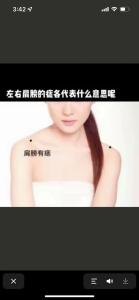 左肩膀有痣代表什么 左肩上有痣的女人圖解