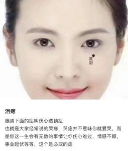 滴淚痣面相好不好 苦情痣與滴淚痣的位置與三生命運(yùn)解析