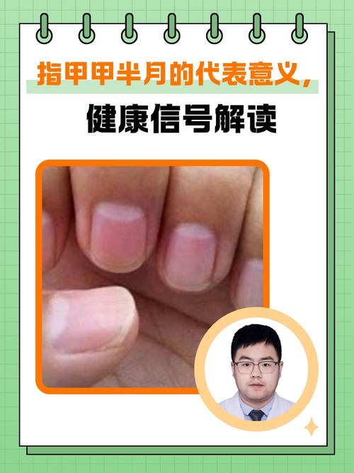 指甲半月痕代表什么