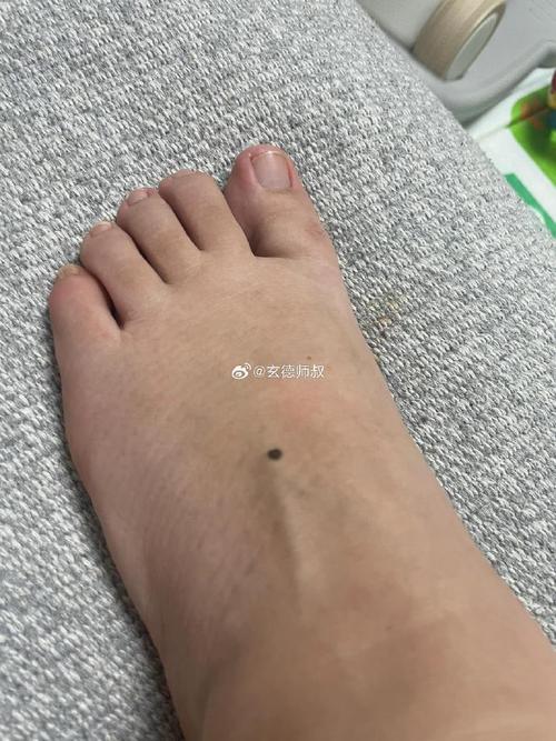 男人腳面有痣代表終身勞碌命？