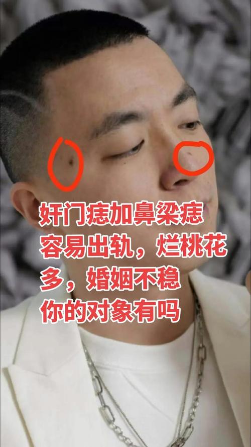 奸門痣會帶來什么厄運嗎