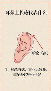 男耳朵長痣面相圖 耳朵長痣男人 耳朵長痣怎么回事