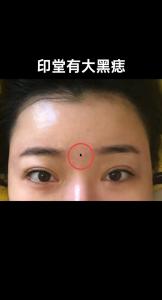 女人印堂有痣主二婚 情感比較不穩定感情波折