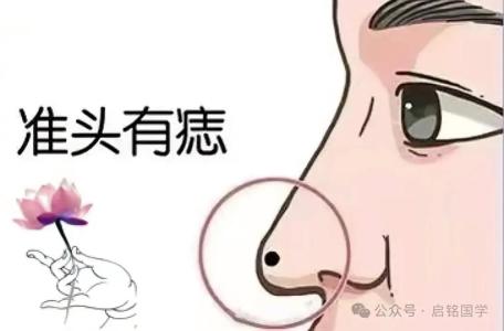 鼻頭有痣的人事業(yè)順利 混得好