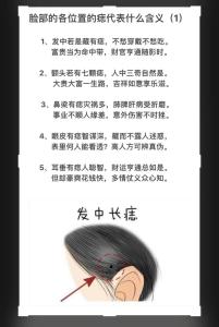 頭發里有痣代表什么   頭發鬢角位置長痣易犯小人