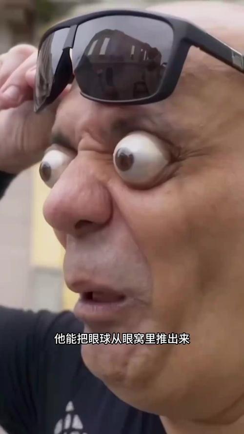 眼球突出的人有什么性格