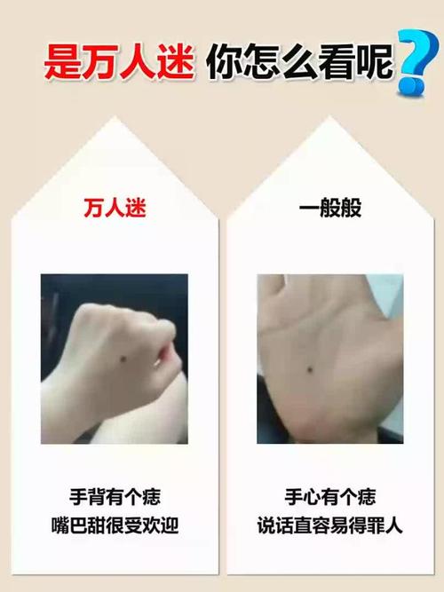 手背上長痣代表什么 男人的手背有痣代表什么