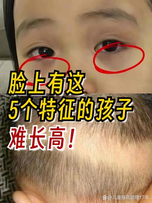 最讓父母沒輒的小孩面相