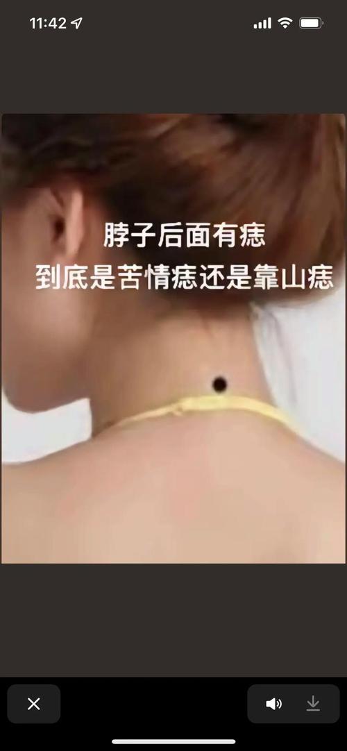 苦命痣長在哪里