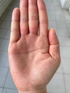 斷掌的人是否短命