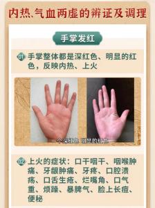 手掌發紅代表什么 手掌發紅手相解析