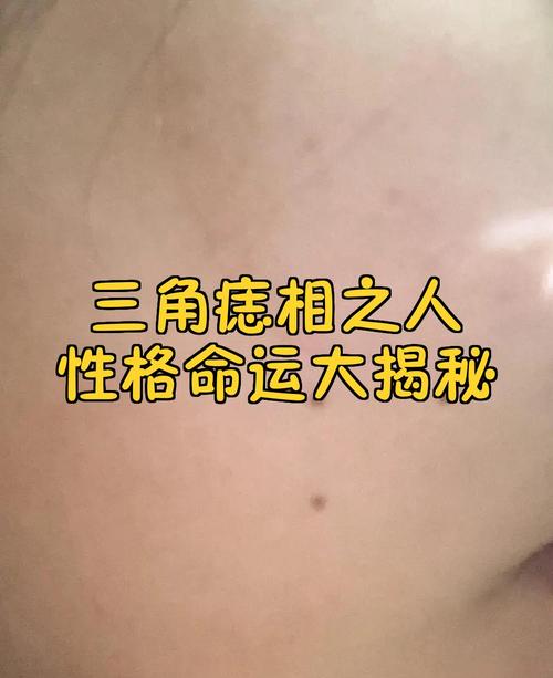三角痣是絕命痣嗎