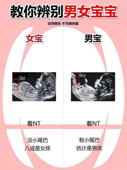 生男生女早知道：從彩超單看生男生女