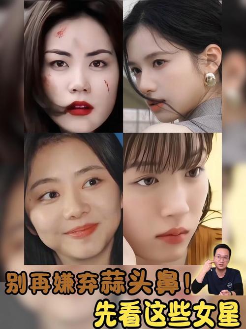 盤點蒜頭鼻女明星都有哪些