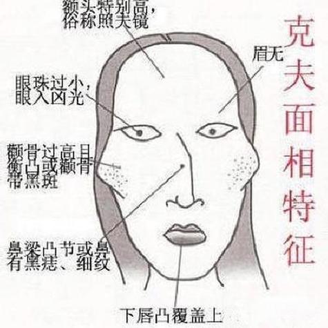 顴骨高克夫是真的嗎