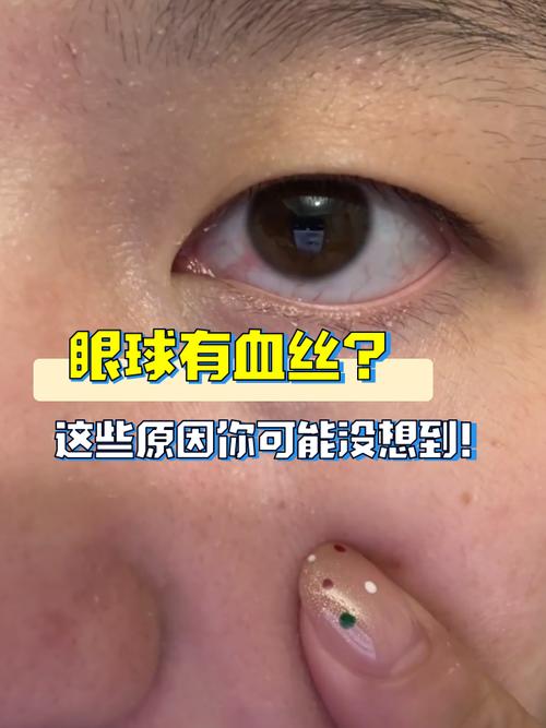 什么面相的男人有牢獄之災(zāi) 眼球有紅血絲