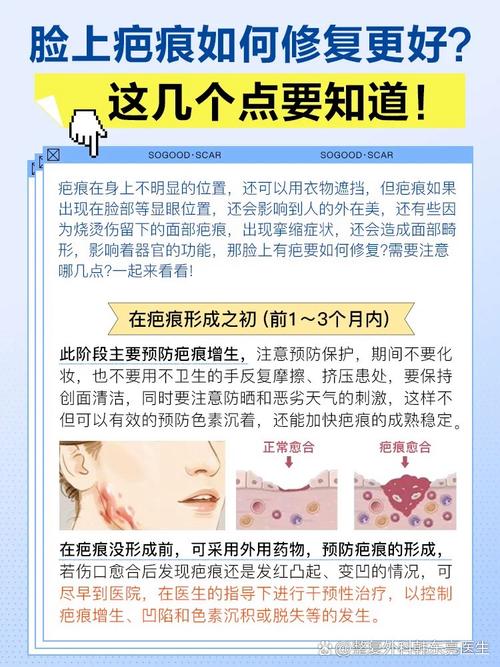 面部疤痕對個人運勢的影響