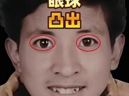 打死不能嫁的男人面相 眼球外凸人中很長(zhǎng)