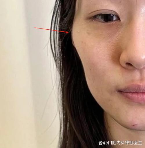 顎骨突出的人都很丑嗎 什么樣的臉型最難看