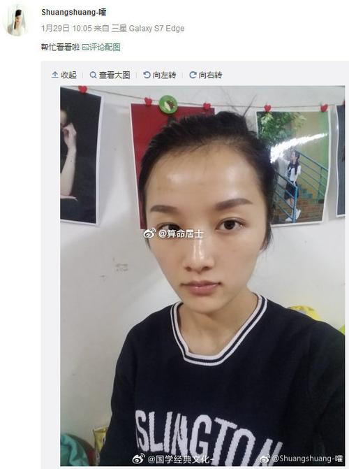 額頭上半部分凸起面相 額頭凸起有貴人運