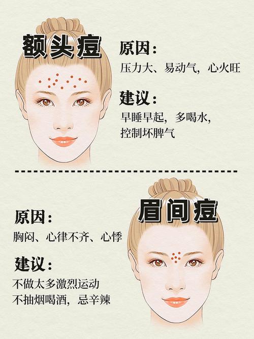 面相圖解：如何通過青春痘知曉健康運