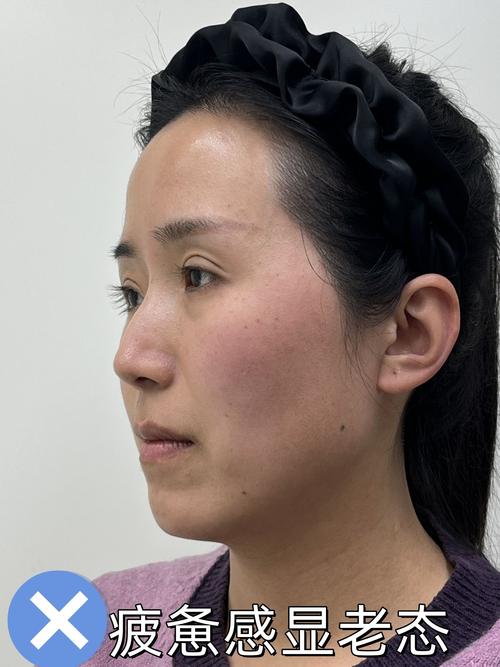 人中不明顯的面相