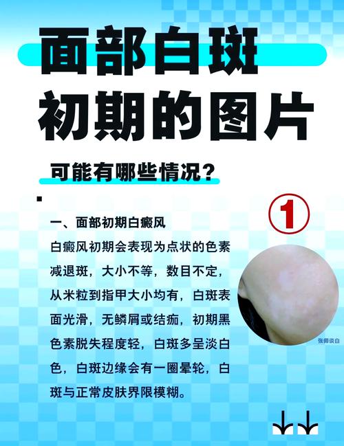 面部發(fā)白：面相學(xué)氣色為白色身體健康