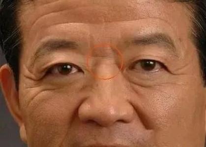 男人鼻梁上有橫紋面相