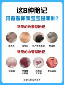 男人胎記長在哪里最好 胸部有貴人運好