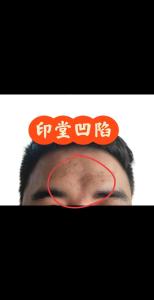 壞男人面相特征 印堂窄肚量淺