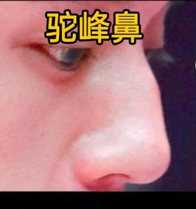 男人面相：鼻子起節(jié)的人婚戀命運會怎樣