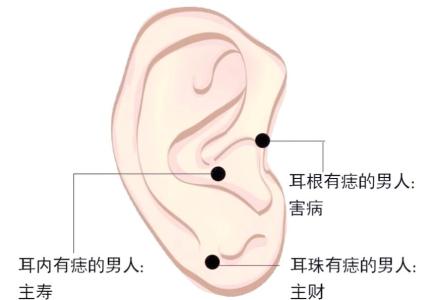 男人面部痣的吉兇 耳上痣才華溢