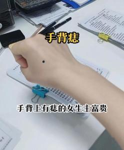 極少見大富大貴痣手中 手心掌富手背掌貴
