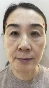 女人的好面相 額頭渾圓 眼袋平滿(mǎn)