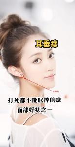 耳垂有痣的女人代表什么意思 好不好