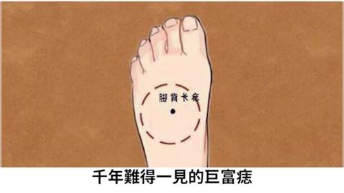 女人橫財痣長哪里 腳背長痣理財能力強