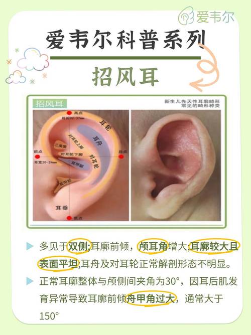 招風(fēng)耳的人好嗎?招風(fēng)耳是好還是壞?